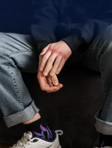 Personal injury law services in Clearfield